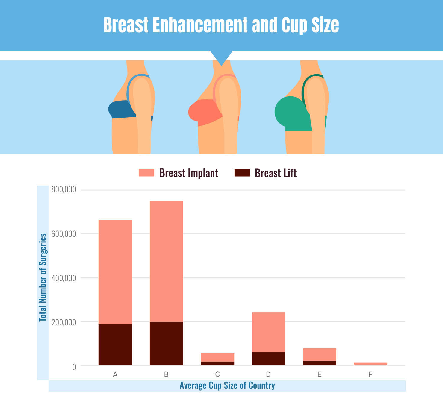 Most preferred breast size in percentage among the plastic